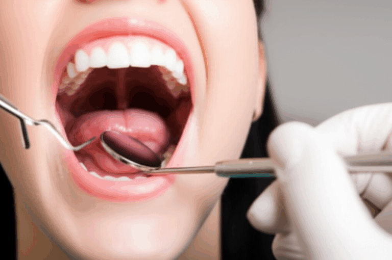 Can a Dentist Diagnose Tonsillitis Understanding Their Role in Your Throat Health