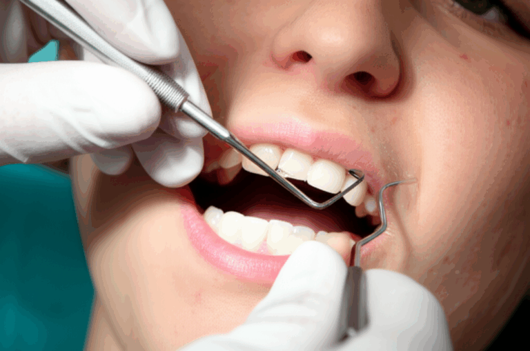 Can a Dentist Fill a Hole in a Front Tooth Understanding Your Repair Options
