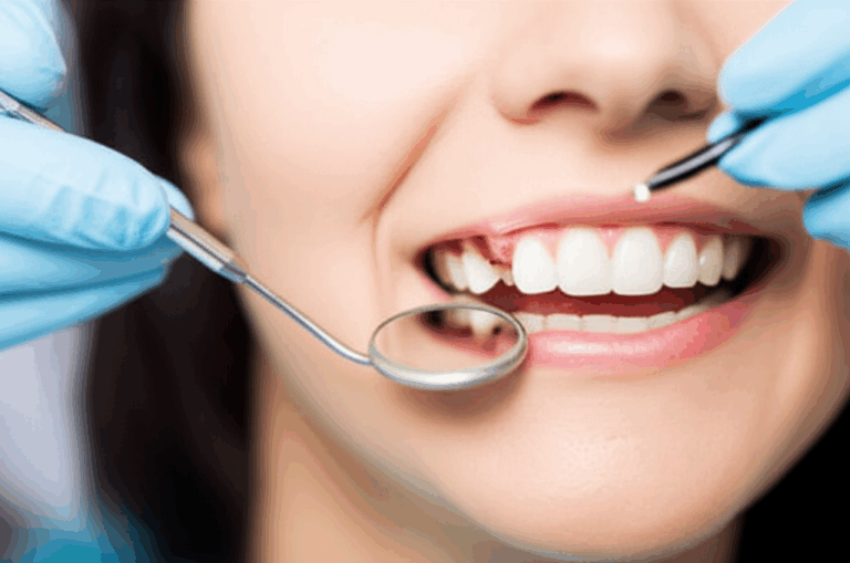 Can a Dentist Fix a Chipped Tooth Same Day Your Urgent Guide to Immediate Repair