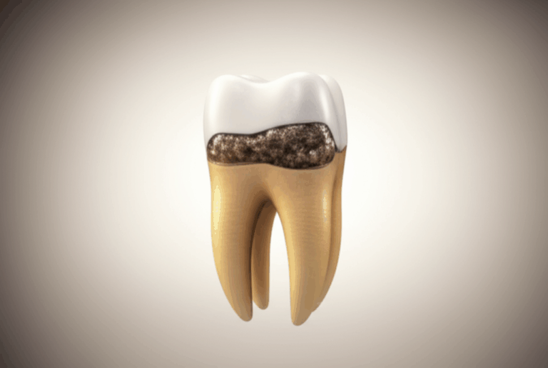 Can a Dentist Fix a Rotting Tooth Your Simple Guide to Fixing Bad Teeth