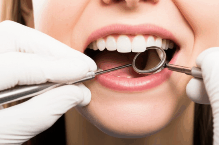 Can a Dentist Help with Canker Sores