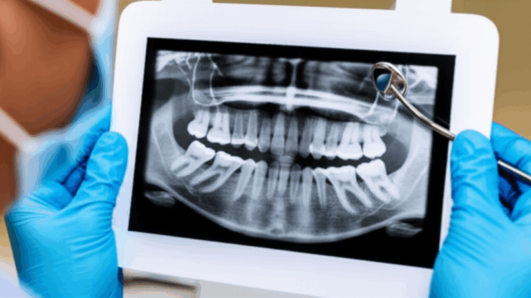 Can a Dentist Pull a Tooth If It Is Infected My Personal Guide to What Really Happens And What You Need to Know