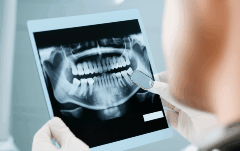 Can a Dentist Pull an Infected Tooth Without Antibiotics Understanding the Risks Realities