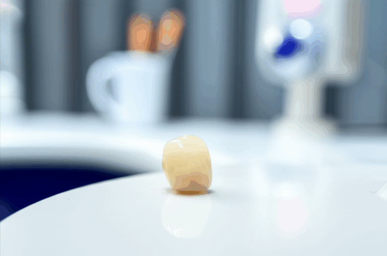 Can a Dentist Put a Fallen or Loose Crown Back On Your Easy Guide to Re cementation