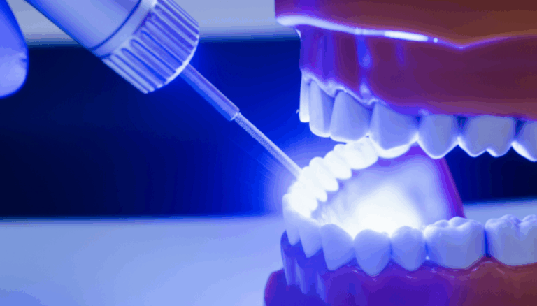 What Is the Blue Light Dentists Use The Friendly Guide to Dental Blue Light Technology